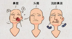 鼻涕不止，头痛难耐？专家教您如何科学应对鼻窦炎