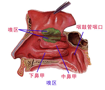 慢性单纯性鼻炎该怎么治疗?