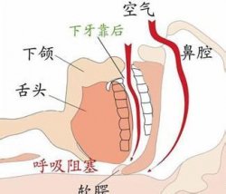 “瞌睡哥”坐车打鼾惹人纠纷