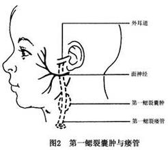 腮腺导管的位置示意图图片